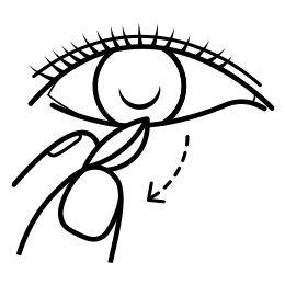 Lens removal